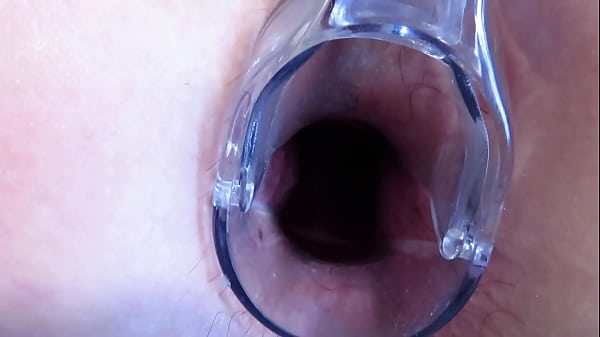 Gynecological Speculum Stretching: MILF with Big Butt and Gaping Anus and Vagina mXm.SEX homemade video anal asshole pussy